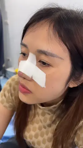 Bóc team chiếc mũi 9 ngày tuổi nhà Hiếu nha 😘 #muicautruc #nguyenvanhieu #nangmui 