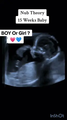 Nub Theory 15 week's baby gender prediction gender Reveal #genderreveal #genderrevealparty #genderprediction #genderdetermination #foryourpage #foryou #viralvideo #pregnantlife #pregnant #15weeks #15weekspregnant #nubtheorydrawing #nubologists #nubtechs #thenubtheory #nubcorrect 