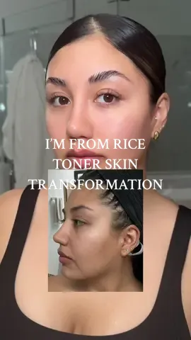 @imfrom_us rice toner is my holy grail for a glowing even complexion. I’ve had all sorts of expensive facials tried so many skincare products and nothing has come close to giving my skin this transformation. Rice extract has literally been a miracle for my skin 🌾 #hyperpigmentation #koreanskincare #toner #glassskin #evenskintone #glowyskin #koreanbeauty #imfromricetoner 