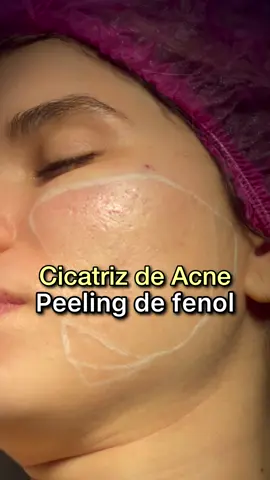 Aguardem os resultados ✨