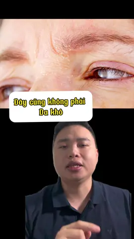 Da bong tróc ở 2 bên lông mày, mũi, má bạn đã gặp tình trạng bệnh lý này chưa ? #CapCut  #zahanclinic #drtrangiakhanh 