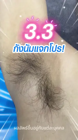 3.3นี่ ออนนี่แจกฟรี!!เลเซอร์ขนรักแร้ด้วยโปรแกรม Long Pulse ND Yag✨ขนเยอะ ขนหนาดกดำ ก็เอาอยู่ตอขนหายเกลี้ยง กำจัดลึกไม่เหลือซากด้วยเลเซอร์กำจัดขน นวัตกรรมจากประเทศอิตาลีง่ายๆเพียงเเอดไลน์กังนัมก็รับสิทธิ์ฟรีไปเลย #gangnamclinic #กังนัมคลินิก  #รีวิวบิวตี้ #เลเซอร์รักแร้