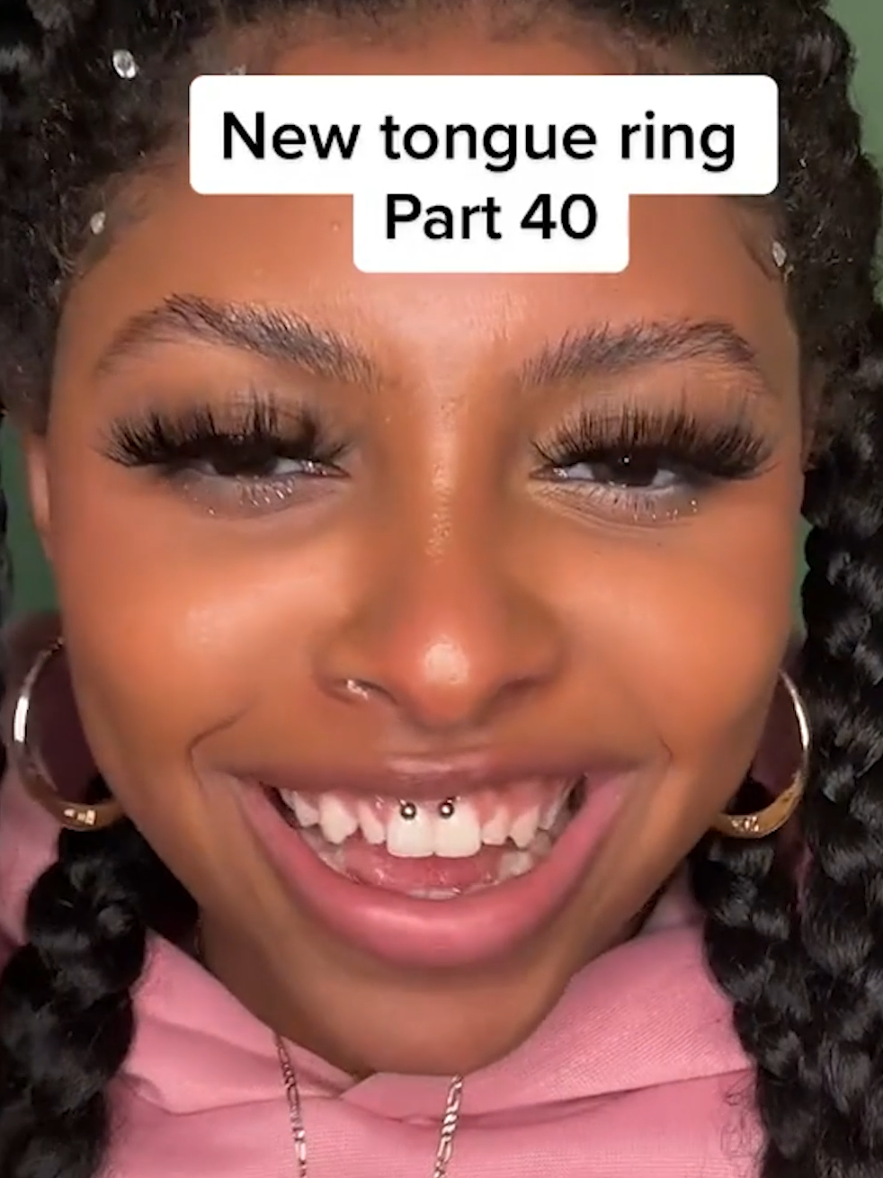 How This TikTok Revealed A SECRET About Her Teeth! 🤔🦷 #teeth #braces #dentist