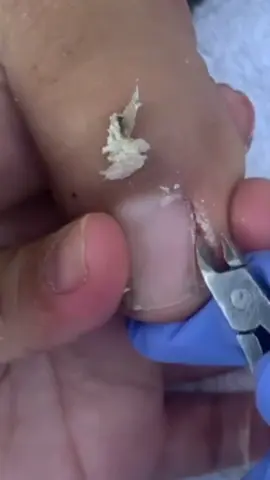 Lấy khoé siêu phê #fyp #nails #nail #laykhoe #laykhoemongchan #laykhoechan 