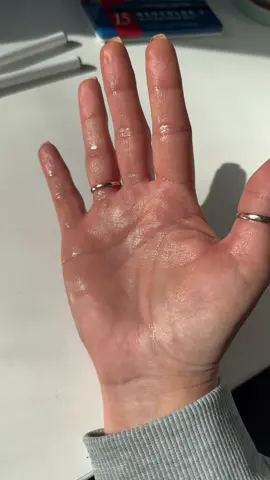 Sweaty hands gang! We understand the struggle…! 😰💦💦 We can help! #sweatproblems #excessivesweating #sweatyhands #sweatypalms 