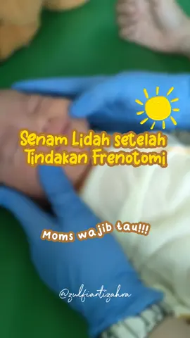 ⚠️Save and share this video⚠️ Tongue-tie adalah salah satu penyebab susahnya pelekatan pada bayi NewBorn. Meskipun tidak semua kondisi bayi seperti itu. Kebetulan Jauhar memiliki tongue-tie yg mengganggu dan perlu dilakukan tindakan.  Apa yang perlu dilakukan setelahnya? Ya senam Lidah. Yang perlu Moms perhatikan:  1. Pastikan tangan ibu sudah cuci tangan dg bersih 2. Potong kuku agar tidak melukai lidah bayi 3. Kalau sy dulu dianjurkan melakukan senam 5x sehari sesuai waktu sholat 4. Jika diberikan obat khusus oleh dokter diberikan sesuai dg anjuran beliau yaa Alhamdulillah setelah itu tidak ada drama puting lecet lagi 🤗 Semoga bermanfaat ♥️ Yuk Moms yang mau sharing terkait menyusui bisa comment dibawah ya 👇 #bayi #tonguetie #frenotomi #newbown #senamlidah #menyusui #breastfeeding #fyp 