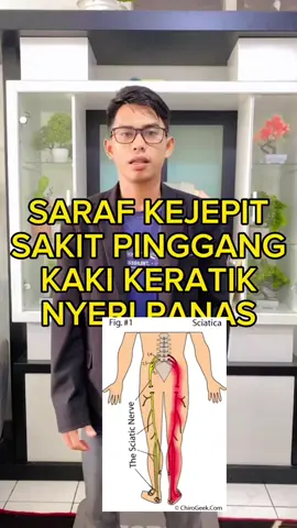 Saraf kejepit menjalar ke kaki coba lakukan ini #adiys #totoksaraf #sarafkejepit 