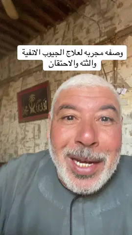 #اكسبلور #اكسبلور محمود الصعيدي 