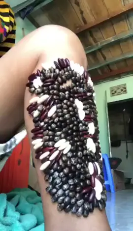 I decided to remove it sooner #ticks #ticksremoval #fyp 