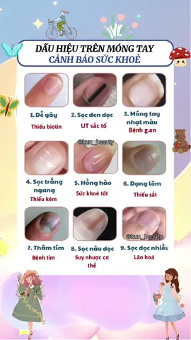 Đâu hiệu móng tay cảnh báo sức khoẻ bạn! #kun_beauty #mongtay #suckhoe #suckhoesắcđẹp #suckhoechomoinguoi #viral #xuhuong 