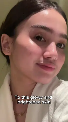 Achieve the glow you deserve! ✨🧖🏻‍♀️  #skintific #SkintificPH #skintificbrighteningserum #niacinamide #skincare 