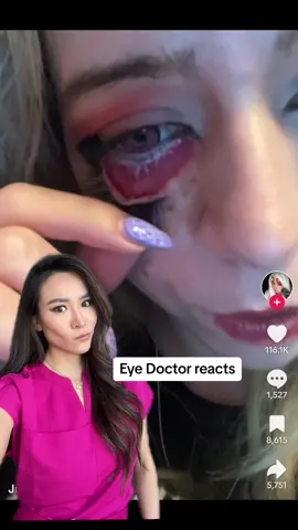 eye doc reacts 😱 #lashes #skincare #eyes #makeup #fxmakeup 