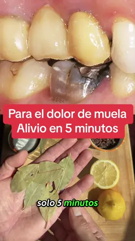 Dolor de muela #dolordemuela #dolor #muelasdeljuicio #muelas #salud #dentista #medicina #parati #fyp #foryoupage 