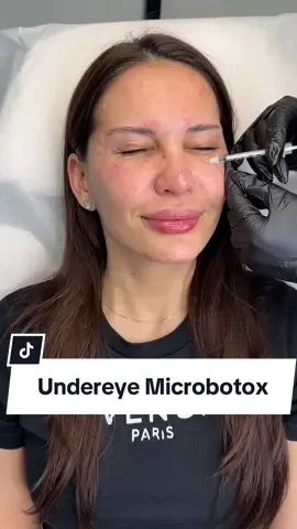 Microtox is a game changer for fine or tiny lines directly under your eyes. If you’re not prone to under eye swelling, get your practitioner to do this treatment for you. It completes the look! DM to book or Text: 647-676-0694 📍325 Weston Road Unit 11B  📍@lashesandlipstickca