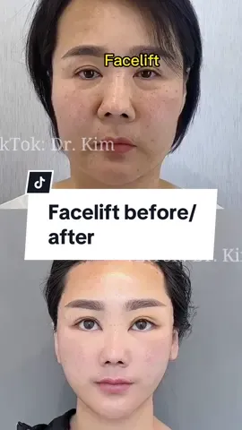 #drtranhaiglobal 