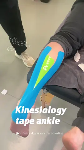Kinesiology tape treats achilles tendonitis and calf pain.This can help you better tolerate activity and speed recovery.This is good any athlete,including runners,jump sports athletes,etc.#kinesiologytape #achillestendonitis #calfpain  #anklepain #physicaltherapy 