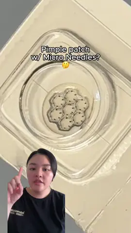 Honestly recommend these for angry and painful pimples 🌋😮‍💨 Product: Easyderm Quick Calming Magnesium Patches w/ Cica Ampoule Available on Amazon! 🛍️ #pimplepatch #acnepatch #acnescars #easyderm #koreanskincare #kskincare #kbeauty 