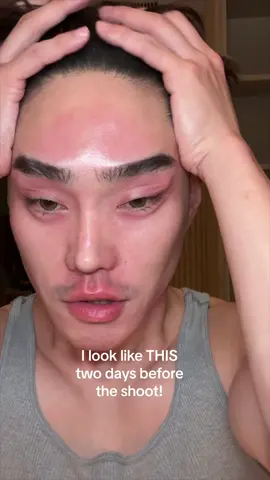 I almost had to cancel everything. How can I go on camera looking like this? Thankfully the new La Mer Fresh Cream cooled my skin down and worked better than I could have imagined @LA MER #skinissues #sensitiveskin #lamer #lamerpartner  #LaMerFreshCream 