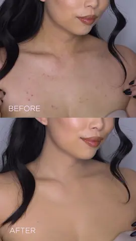 Say hello to confidence with Dermablend's Leg and Body makeup!  From tattoos to scars, stretch marks to body acne scars like @Aliciea Her our lightweight formula has got you covered! Don't let winter weather dull your shine – flaunt your radiant skin with pride! ❄️✨  #Dermablend #SkinConfidence #FlawlessCoverage #BodyMakeup #WinterSkinCare #BodyPositivity #BeautyHacks #Dermablend #SkinConfidence #FlawlessCoverage #BodyMakeup #WinterSkinCare #BodyPositivity #TikTokTrend #BeautyHacks 
