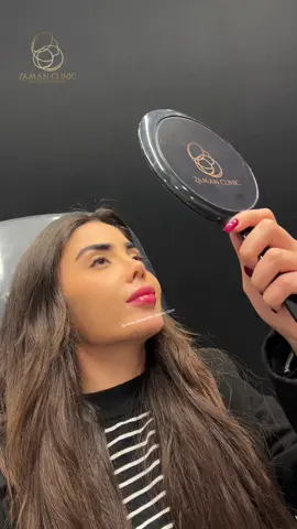 Enhance your beauty with a simple Lip Filler touch 🤍🥰 #zamanclinic  07702281313 07512281313 —————— #drhemnzaman  #fyp #explore #kurd #iraq #slemani #erbil #duhok #kirkuk #baghdad #basra #ranya #kurdistan #chamchamal #qaladze #explorepage #uk #halabja #likes #tiktok #lipfiller #aesthetic #Science #art #medical #medicine #beauty #aestheticmedicine #viral #goviral #trend #dermatology #derma  