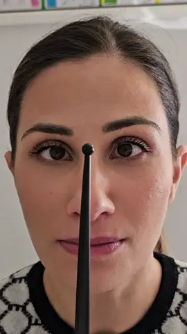 TEST DI CONVERGENZA OCULARE  La convergenza è un movimento sincrono degli occhi verso il naso e viene attivata durante la visione di uno stimolo da vicino. ➡️IL DEFICIT DI CONVERGENZA è un disturbo della visione binoculare molto comune, si può definire come un problema di collaborazione degli occhi per cui, uno dei due ha una forte tendenza a deviare verso l'esterno. .  ⚠️ L'insufficienza o deficit di convergenza è spesso associata ad una varietà di sintomi come:  1. Affaticamento visivo 2. Emicrania serale 3. Visione offuscata 4. Diplopia 5. Visione offuscata e occhi rossi 3. Cervicalgia .  ⚠️ Il deficit di convergenza può avere origine oculare, ad un trauma diretto visivo o indiretto (per esempio un colpo di frusta) oppure può essere l'espressione di un adattamento visivo ad un'altra causa per esempio a livello dell'apparato stomatognatico (relativo all'occlusione o ATM) o in alcuni casi come segno neurologico! ⚠️ In questi casi cosa si fa?⚠️ È fondamentale indagare la causa ed in molti casi risulta efficace la riabilitazione visiva ortottica!  . #ildocosteopata #postura #osteopatia #oculista #occlusione #ortottica #occhi #testposturale #medicina #andiamoneiperte #neiperte 