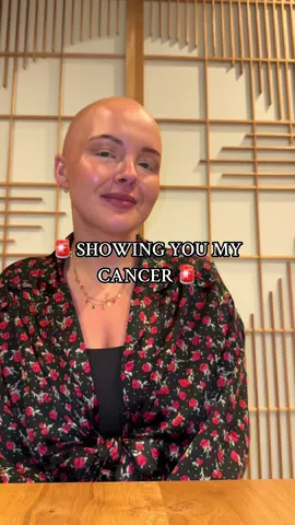 🛁 it would mean a lot if you stay with me until the end :) #cancer #stageivcancer #japan #terminalcancer 