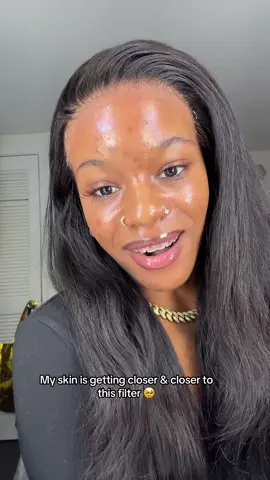 and i got like 4 lashes left😍 #acne #acnejourney #clearskinfilter #blackgirlwithacne 