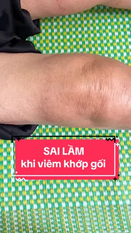 Khớp gối đang bị sưng viêm thì không nên chườm ấm mà nên chườm lạnh nhé mọi người #viemkhop #dauxuongkhop #chườmnóng #chườmlạnh #bácsĩ_thụ #điềutrịxươngkhớpchuẩnykhoa #thoaihoakhopgoi 