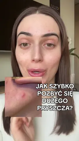 Serum, które działa jak plaster na wyprysk? Znalazłam ten idealny produkt, dzięki któremu możesz spokojnie się bawić, ze świadomością, że Twój pryszcz jest zabezpieczony, a pimple patch robi swoje! @Kiehl’s Since 1851 #kiehlspolska #skincare [współpracapłatna] 