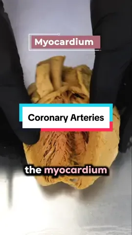The most common type of heart disease?🫀#highcholesterol #sus #bro  #heart 