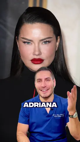 Adriana Lima  Otra famosa que está siendo criticada por los procedimientos que se a realizado⚠️ ¿Qué te parecen estos procedimientos?  #médicoestético #adrianalima #victoriasecretfashionshow #pilowfacefilter 