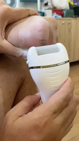Electric Callus Remover #callusremoval #fypシ゚viral #affiliatemarketing 