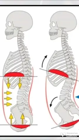 #gimnasio #gym #bracing #tecnica #abdomen #salud #Fitness 