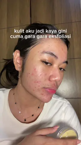 yang suka physical exfo hati hatii nanti skin barrier nya bisa rusak kalau pakai nya salah yaa