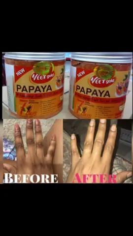 VEET GOLD SCRUBS  CARROT WHITENENING SALT SCRUB - Body scrub.  PAPAYA WHITENENING SALT SCRUB  Total benefits  Anti pimples  Super whitening  Anti wrinkles  Clear black zones  Clear dark spots  Anti dark spots  Ksh 1500 WhatsApp no on bio to order  #SkinCare  #skincaretips  #SkinCare101  #veetgoldpapaya  #veetgoldcarrot 