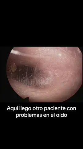 #limpiezadeoidos#interesting#entretenimiento 