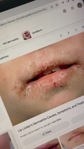 GUESS WHAT’S BACK?! Tell your lips I’m sorry it took so long 🥲🥹 