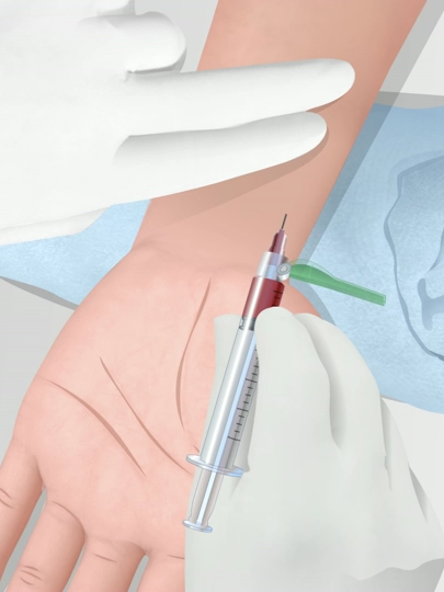 Lay khi mau dong mach Nguon Elsevier