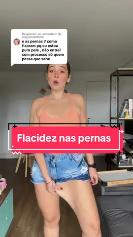 Respondendo a @nogueiraedlaine a flacidez das minhas pernas depois de emagrecer 60kg #bariatrica #emagrecimento #obesidade #flacidez 
