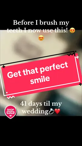 Trying to get this smile right before our BIG DAY!! 💍😍❤️ . . . #gurunanda #teeth #clean #dentalhygiene #dental #dentist #teethwhitening #shine #fyp #fypシ #foryou #foryoupage #springbreak 