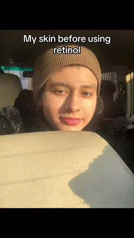 Ive been on retinol for 6 months. The purging has stopped. But i dont want to use it anymore. #skin #thatelle101 