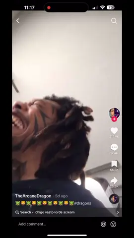 Me when i stub my toe #fyp #foryou #foryourpage #xyzbca #viral 