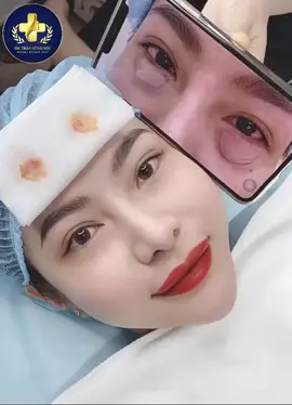 💗BÓC MỠ NỘI SOI - ƯU ĐÃI LỚN CHỈ 1.500K 🌹Chỉ mất 30P - Có ngay đôi mắt vạn người mê ✅ Đẹp ngay sau khi làm ✅ Không khâu vá ✅ Không tổn thương ✅ Không cần nghỉ dưỡng ✅ Giúp loại bỏ phần mỡ dư thừa để có đôi mắt trẻ và đẹp hơn ✅ Không phát sinh chi phí ✅ Hỗ trợ phí đi lại - Giảm 10% nếu dẫn bạn đi cùng Được chính tay các Bác Sỹ trên 10 năm kinh nghiệm thực hiện. 👉 NHẬN ƯU ĐÃI NGAY BÂY GIỜ