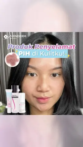 Produk ampuh untuk atasi PIH di wajah😘 #airinbeauty 