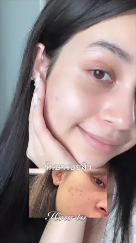 เซรั่มลูกรักเลยอันนี้😭💗🫶🏼🫶🏼🫶🏼#vitaminconcentratedserum #จุดด่างดำ #รอยสิว  #สีผิวไม่เรียบเนียน #numbuzin #รีวิวบิวตี้ #รีวิวบิวตี้ 