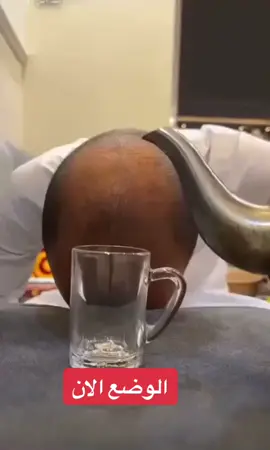 #اكسبلور #ابوعجيب_ابوحصه #وقت_الشاي #بعد_الفطور #رياكشنات_مضحكه 