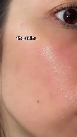 I will never stop using this anua peach serum for my skin, my skin just loves it #anua #anuapeach70niacinserum #niacinamide #skincare #skintips #koreanskincare #koreanskincareproducts #serumviral #glassskin #bestserum #clearskin #smoothskin 