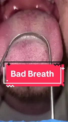 Bad breath ? Mayb its becuase you dont clean your tongue