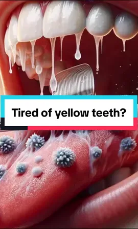 The guru nanda pulling oil is the best product for whitening your teeth and getting better smelling breath right now. If you stay consistent you will see results. #gurunanda #pullingoil #teethwhitening #badbreath #fypシ #fyp 