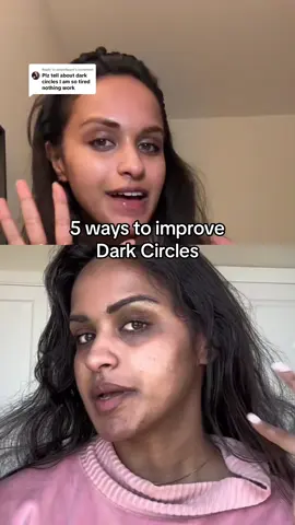 Replying to @sweetheart Genetic Dark Circles are the worst! But here are some things i learnt on my own journey. Tough to fit everything in! Might make a separate video expanding on each point later! #hyperpigmentation #hyperpigmentationtreatment #undereyebags #undereyecircles #darkcircles #hydroquinone #skincare 
